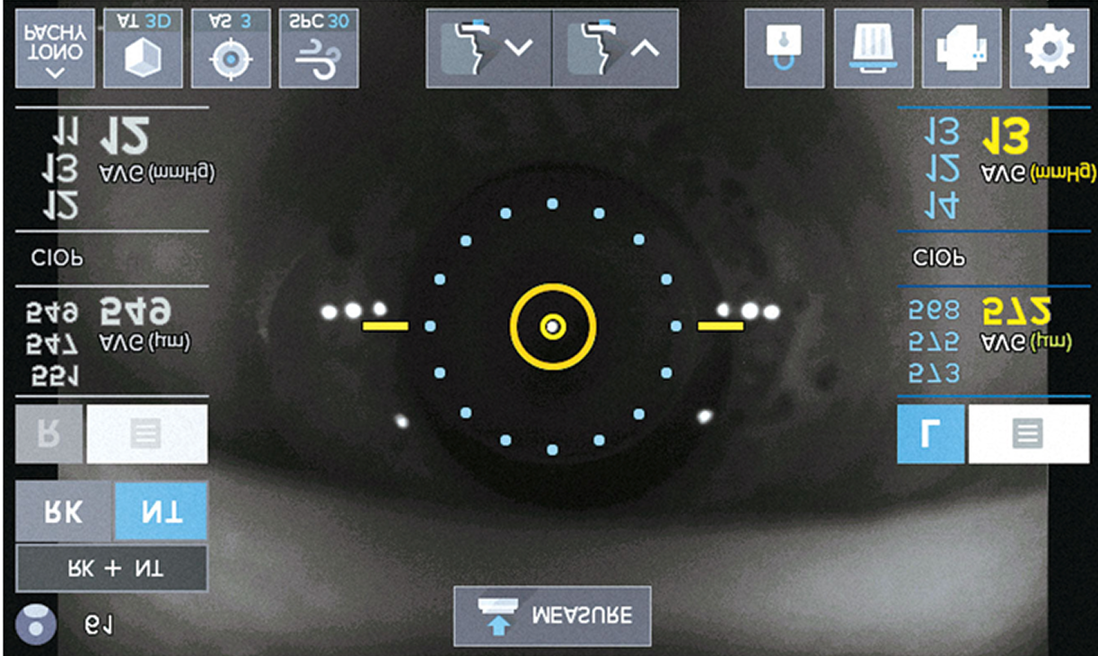CCT (espesor corneal central):