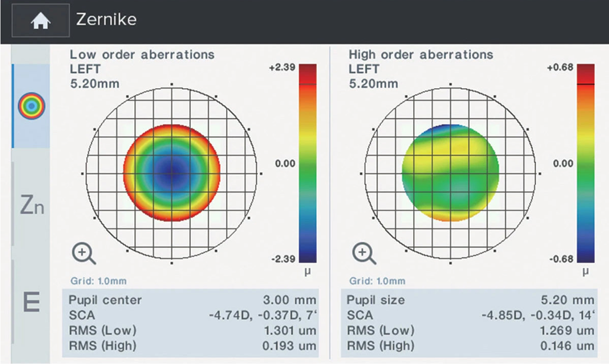 Mapa Zernike para lentes personalizadas: