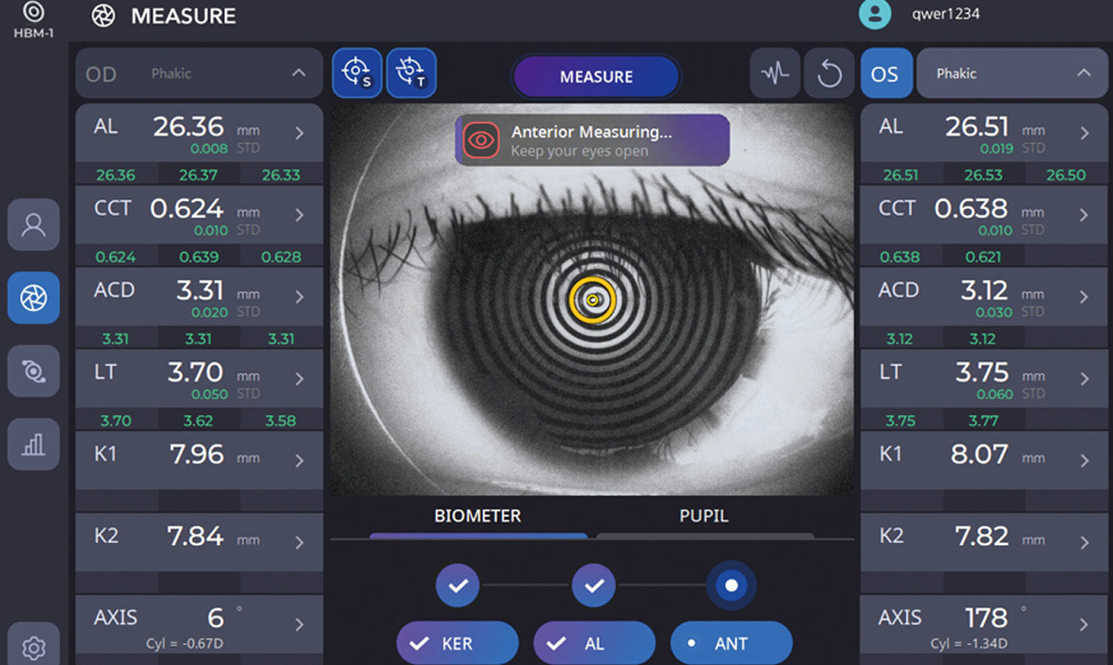 Flujo de trabajo optimizado para cirugía de cataratas: