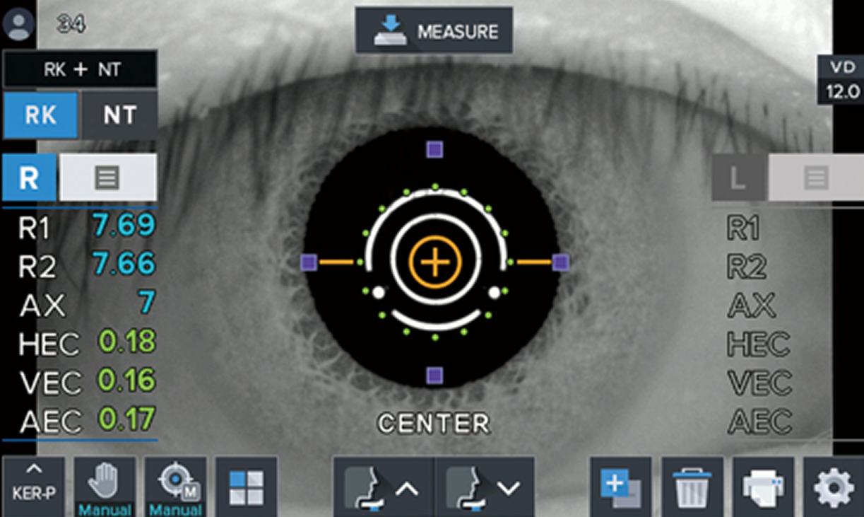 Control de soplado inteligente: